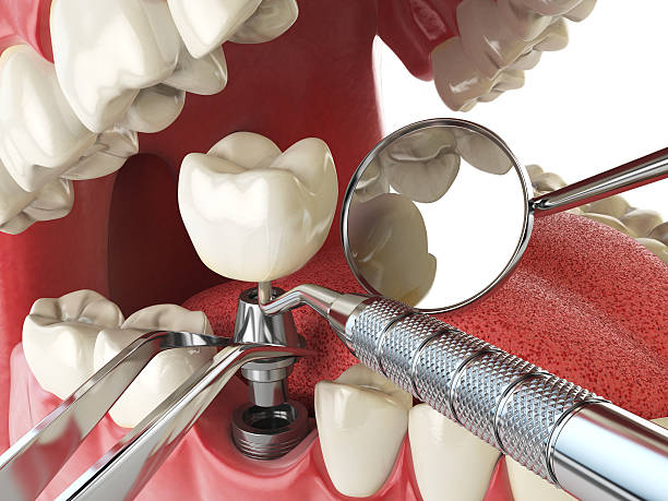 Best Emergency Tooth Extraction in Taft Mosswood, CA